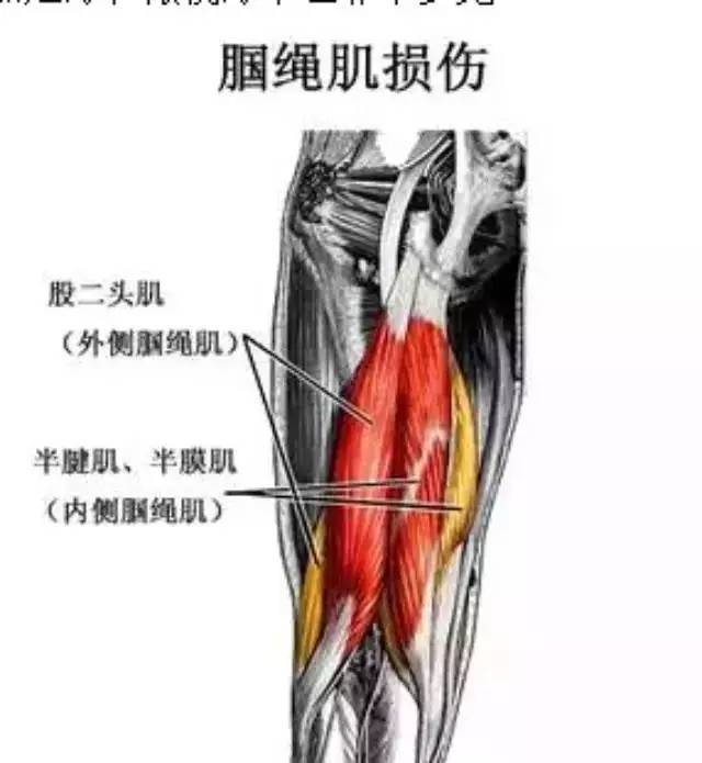 伤痛腘绳肌大腿后侧伤痛