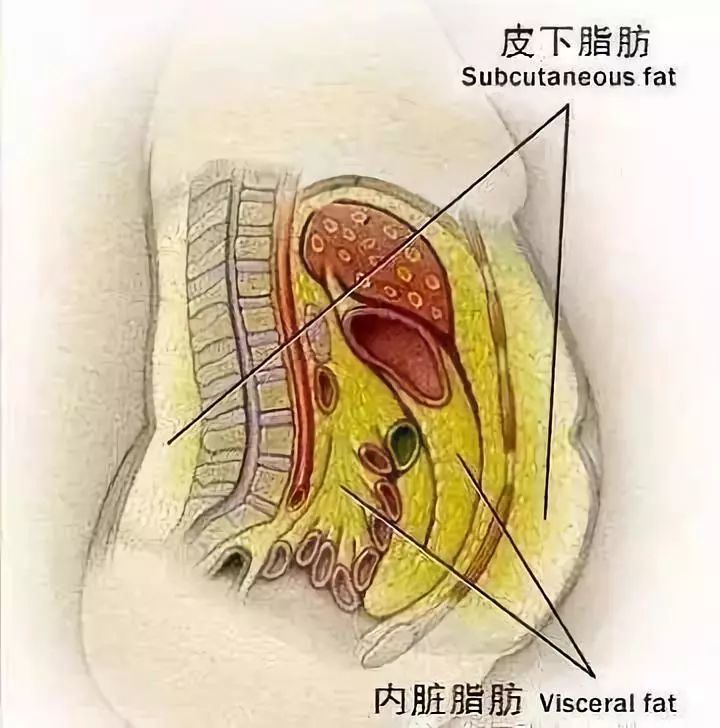 一般来说,很多女生都属于皮下脂肪过高的类型,而男生通常属于内脏脂肪