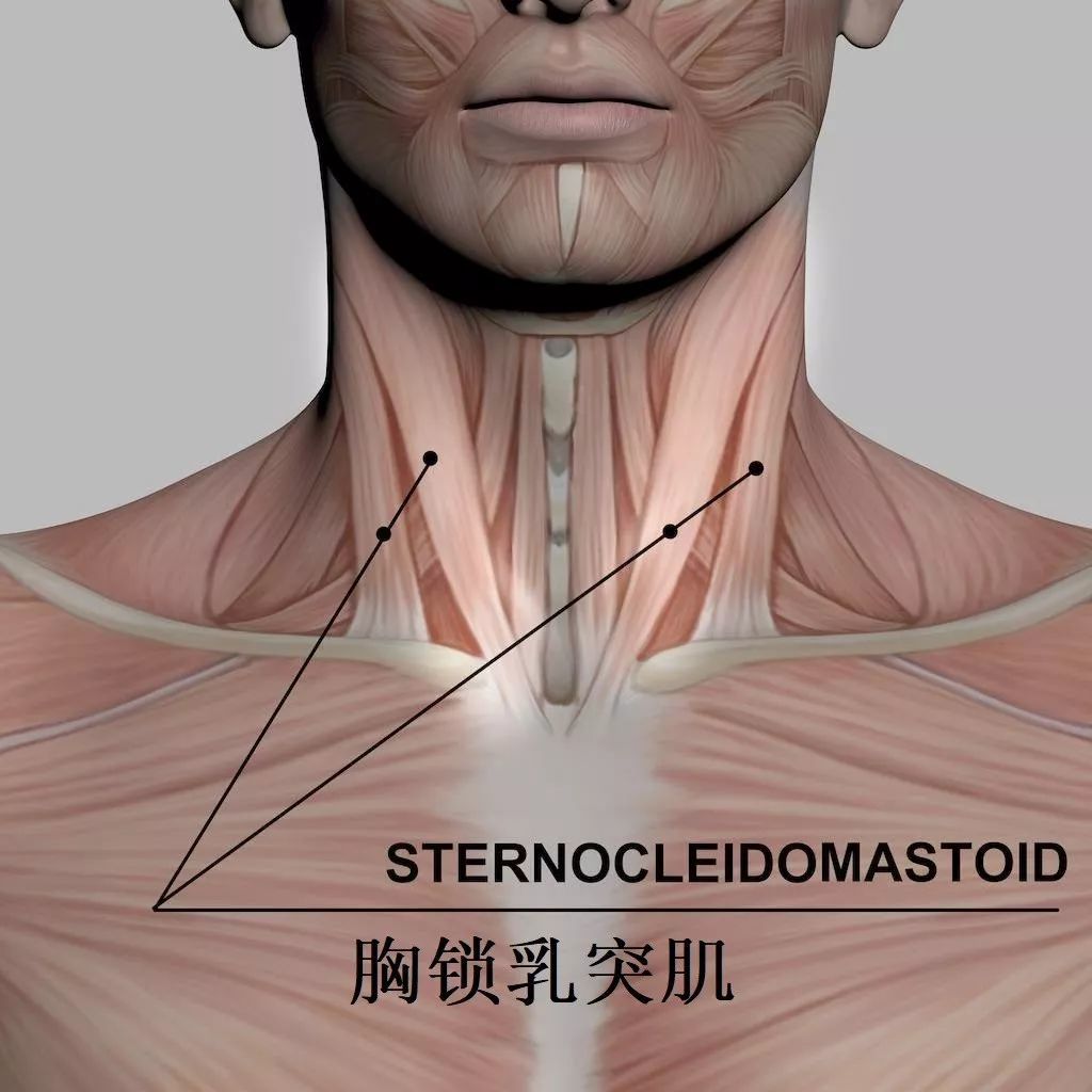 由颈部中线,胸锁乳突肌和下颌骨勾勒出的区域就是颈部前三角,该区域可