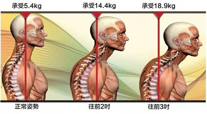 加强颈部肌肉训练