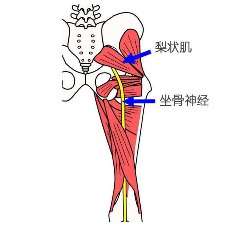 久坐不适未必是坐骨神经痛也可能它在作祟
