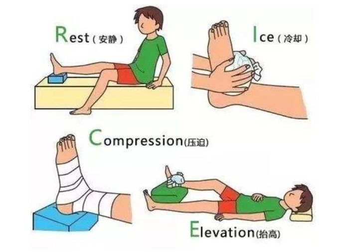 扭伤后急性处理告别冰敷,忘记rice用peace和love