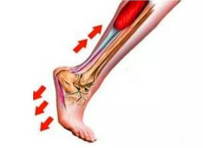 足底筋膜炎这种病症多发生于长跑人群,因为长期腿筋,脚背,小腿和