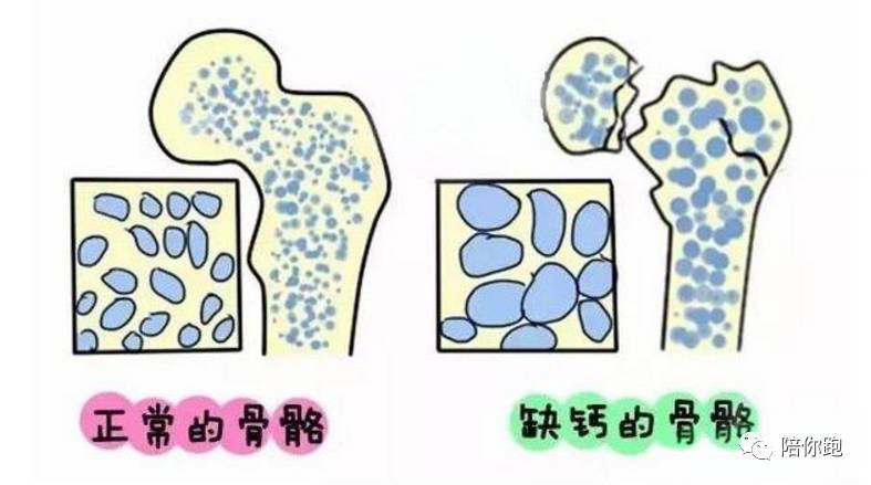 为什么中国人普遍缺钙? | 健康一分钟