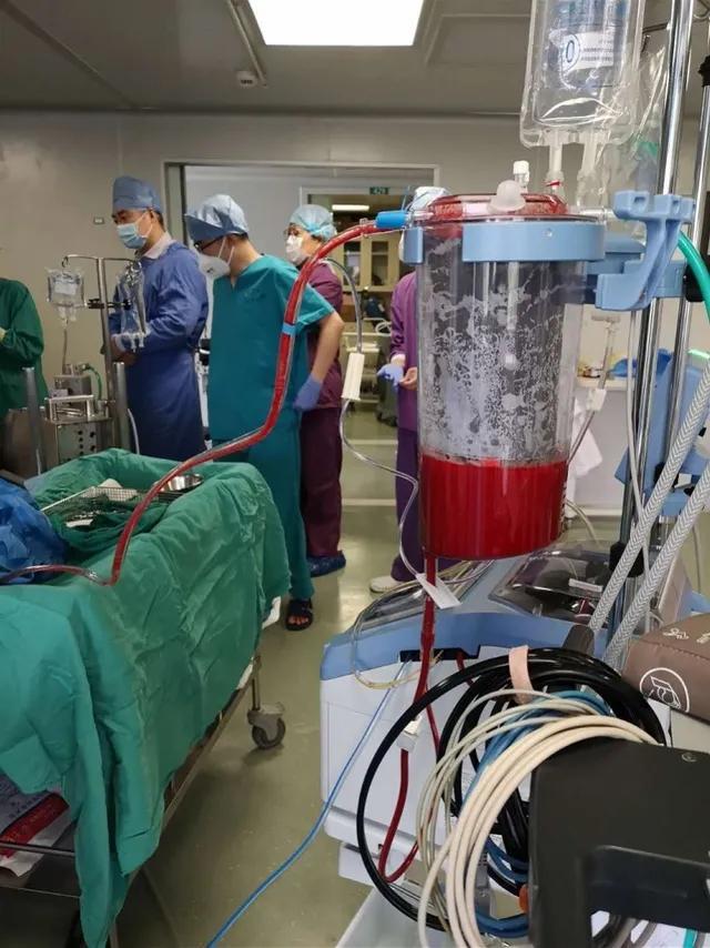 28岁青年猝死，广州医护1.5万次胸外按压救回！他醒后丢掉一个月记忆