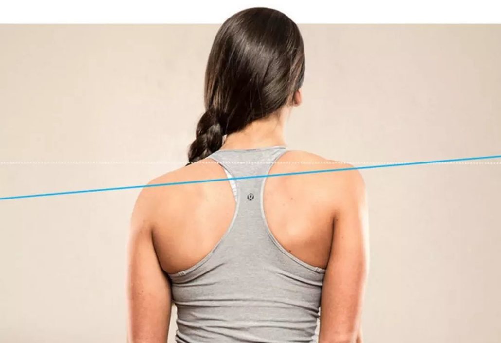 从背后看过去,可以很明显地发现两边肩膀的高低落差.何谓高低肩?