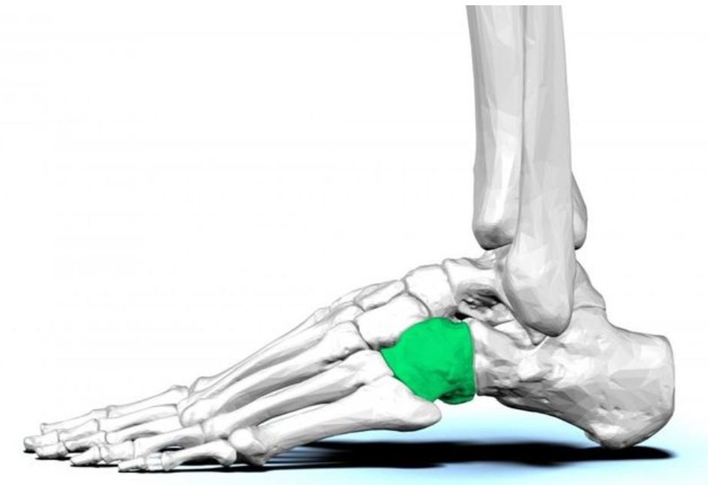 医学上,将前述这类状况归类为骰骨症候群,常见引起的原因有但不限于