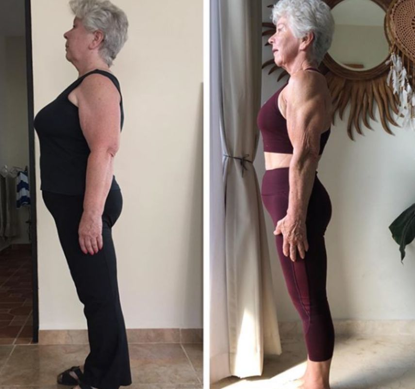 73岁老妪减重245kg大胆秀出美背