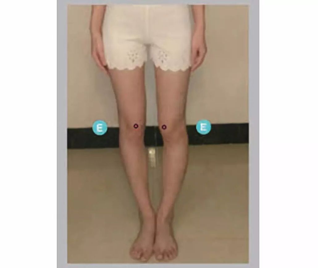 什么时候我们健康体态的标准聚焦在了胖瘦上