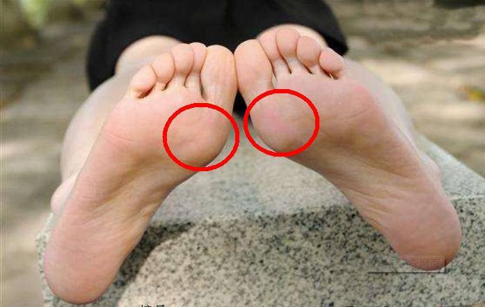 是:前脚掌先落地,前脚掌外侧最先接触地面,接着是跖球部(俗称"拇趾球"