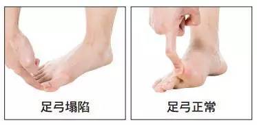 如果走路时脚掌控制出现问题,跑步也会出现问题.